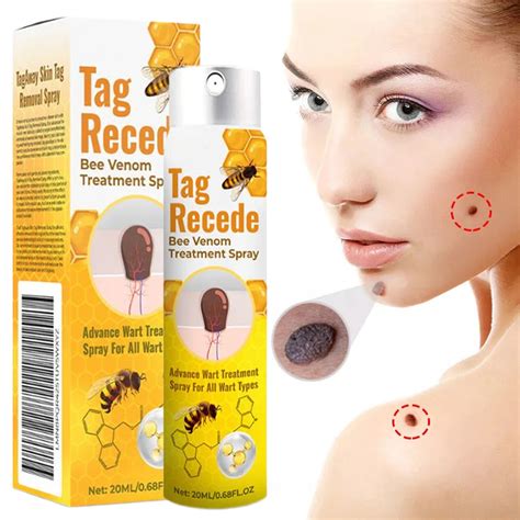 does bee venom remove dark spots.